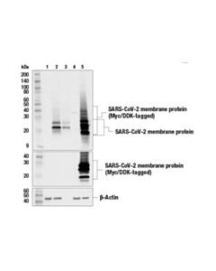 Cell Signaling SARS-CoV-2 Membrane Protein (E5A8A) Mouse mAb 20 uL