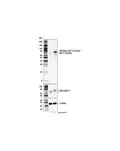 Cell Signaling Phospho-ATF-2 (Thr71)/ATF-7 (Thr53) (A8J7P) Rabbit mAb 20 uL