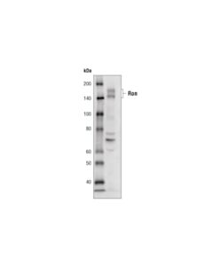 Cell Signaling Ron (C81h9) Rabbit mAb (Biotinylated)