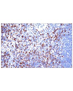 Cell Signaling Trbc1/Tcrbeta Constant Region 1 (E6z3s) Rabbit mAb (BSA And Azide Free)