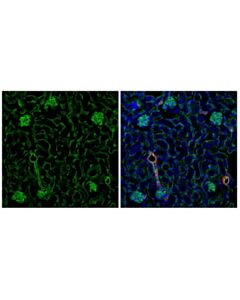 Cell Signaling CD31 (PECAM-1) (F2N3M) Rabbit mAb