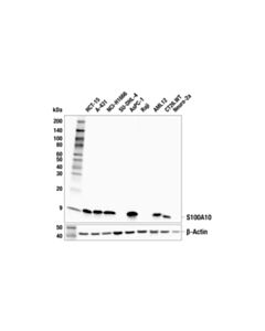 Cell Signaling S100a10 Antibody