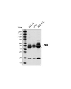 Cell Signaling Car (D3w3g) Rabbit mAb