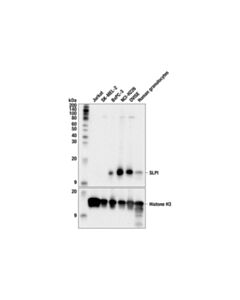 Cell Signaling SLPI (F6Z7H) Rabbit mAb