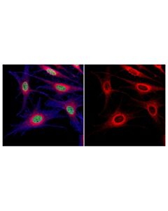 Cell Signaling Rab7 (D95f2) Xp Rabbit mAb (Alexa Fluor 555 Conjugate)