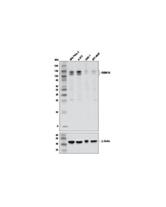 Cell Signaling Rbm10 Antibody