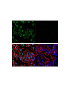 Cell Signaling Cdk2 (E8j9t) Xp Rabbit mAb