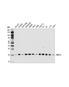 Cell Signaling RPL11 (D1P5N) Rabbit mAb 20 uL