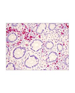 Cell Signaling Signalstain Boost Ihc Detection Reagent (Ap, Rabbit)