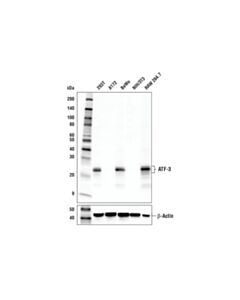 Cell Signaling ATF-3 (E9J4N) Rabbit mAb 20 uL