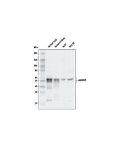Cell Signaling Aldh2 Antibody