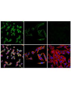 Cell Signaling Il-6ralpha/Cd126 (E5b3p) Rabbit mAb