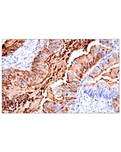 Cell Signaling CD177 (F9O5U) Rabbit mAb 20 uL