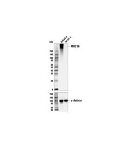 Cell Signaling MUC16 (IHC125) Mouse mAb