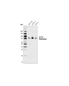 Cell Signaling St14/Matriptase Antibody