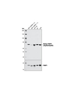 Cell Signaling Asymmetric-Methyl-PABP1 (Arg455/Arg460) (C60A10) Rabbit mAb (BSA and Azide Free)