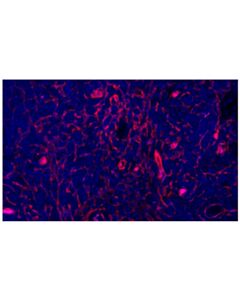 Cell Signaling Cd141/Thrombomodulin (E7y9p) Xp ® Rabbit mAb (Alexa Fluor ® 555 Conjugate)