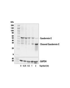 Cell Signaling Gasdermin E (E2X7E) Rabbit mAb 20 uL