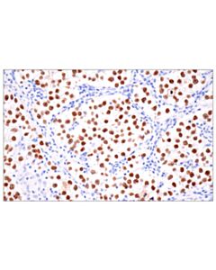 Cell Signaling Sall4 (6e3) Mouse mAb