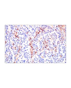 Cell Signaling Pi3 Kinase P110 Delta (E2t2n) Rabbit mAb