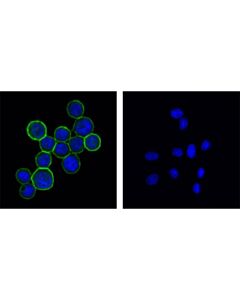 Cell Signaling Her2/Erbb2 (29d8) Rabbit mAb (BSA And Azide Free)