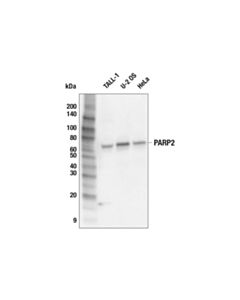 Cell Signaling PARP2 (F3Z6Z) Rabbit mAb 20 uL
