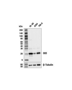Cell Signaling Bid Antibody (Human Specific)