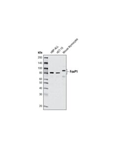 Cell Signaling Foxp1 Antibody