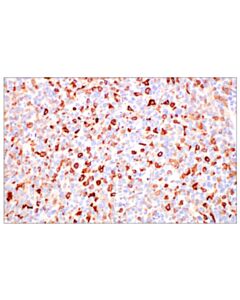 Cell Signaling Fcrn (E4d5i) Rabbit mAb