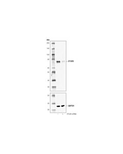Cell Signaling OTUD5 (D8Y2U) Rabbit mAb 20 uL