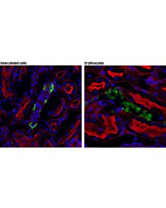 Cell Signaling Ae1/Slc4a1 (D3x1r) Rabbit mAb (If Formulated; Rodent Specific)