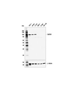 Cell Signaling Satb1 (E5z3u) Rabbit mAb