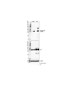 Cell Signaling Phospho-Lat (Tyr220) (E3s5l) Rabbit mAb
