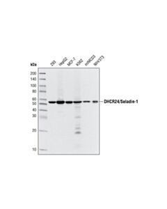 Cell Signaling DHCR24/Seladin-1 (C59D8) Rabbit mAb 20 uL