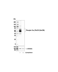 Cell Signaling Phospho-Tau (Thr231/Ser235) (E7g5w) Rabbit mAb
