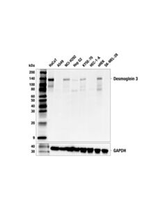 Cell Signaling Desmoglein 3 (5G11) Mouse mAb 20 uL
