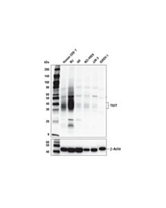 Cell Signaling TIGIT (E6L7H) Rabbit mAb 20 uL
