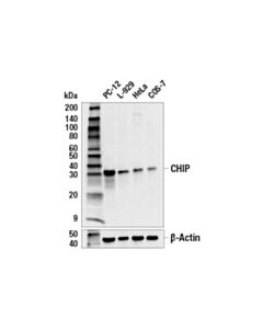 Cell Signaling CHIP (C3B6) Rabbit mAb 20 uL