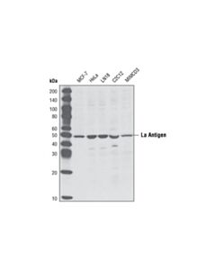 Cell Signaling La Antigen Antibody