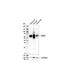 Cell Signaling EAAT2 (E3P5K) Rabbit mAb 20 uL