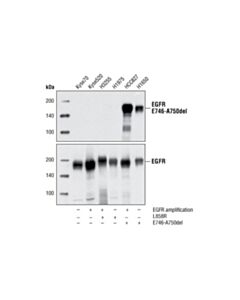 Cell Signaling Egf Receptor (E746-A750del Specific) (D6b6) Xp Rabbit mAb