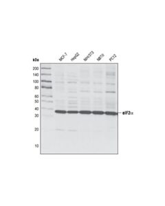 Cell Signaling Eif2alpha (L57a5) Mouse mAb