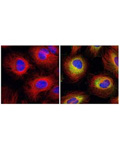 Cell Signaling Beta-Tubulin (9f3) Rabbit mAb (Alexa Fluor 555 Conjugate)