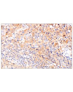 Cell Signaling Rhoa (67b9) Rabbit mAb