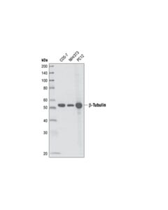 Cell Signaling Beta-Tubulin (9f3) Rabbit mAb
