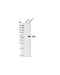 Cell Signaling Atgl Antibody