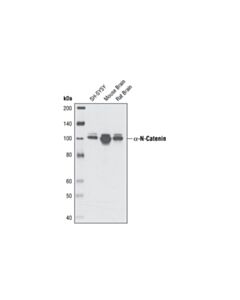 Cell Signaling alpha-N-Catenin (C12G4) Rabbit mAb 20 uL
