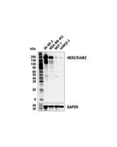 Cell Signaling Her2/Erbb2 (29d8) Rabbit mAb