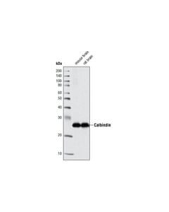 Cell Signaling Calbindin (C26D12) Rabbit mAb 20 uL
