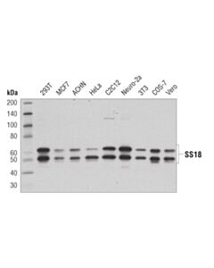 Cell Signaling SS18 (D6I4Z) Rabbit mAb 20 uL